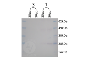 Western Blotting validation image for anti-SNAP Tag antibody (ABIN1573927) (SNAP Tag antibody)