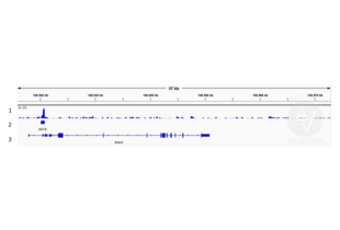 Cleavage Under Targets and Release Using Nuclease validation image for anti-SWI/SNF Related, Matrix Associated, Actin Dependent Regulator of Chromatin, Subfamily A, Member 4 (SMARCA4) (AA 1420-1470), (C-Term) antibody (ABIN6991990) (SMARCA4 antibody  (C-Term))