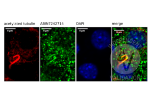 Immunofluorescence validation image for anti-Somatostatin Receptor 3 (SSTR3) antibody (ABIN7242714) (SSTR3 antibody)