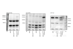Western Blotting validation image for anti-alpha-Kinase 1 (ALPK1) (N-Term) antibody (ABIN3187581) (ALPK1 antibody  (N-Term))