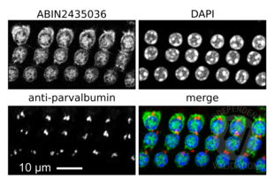 Immunofluorescence validation image for anti-Myosin VIIA (MYO7A) antibody (ABIN2435036) (Myosin VIIA antibody)