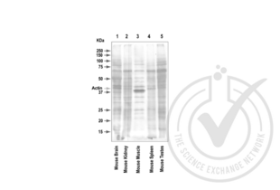 Western Blotting validation image for anti-Actin, beta (ACTB) (AA 2-16) antibody (ABIN1742508) (beta Actin antibody  (AA 2-16))