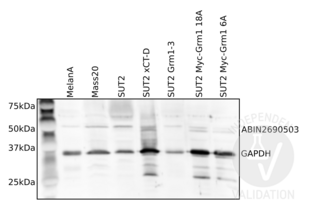 Western Blotting validation image for anti-Solute Carrier Family 1 (Glial High Affinity Glutamate Transporter), Member 3 (SLC1A3) (Cytoplasmic Domain) antibody (ABIN2690503) (SLC1A3 antibody  (Cytoplasmic Domain))
