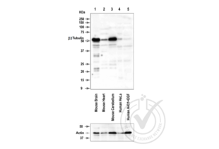 Western Blotting validation image for anti-Tubulin, beta 3 (TUBB3) (AA 443-450) antibody (ABIN1742553) (TUBB3 antibody  (AA 443-450))