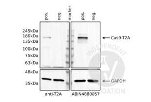 Western Blotting validation image for anti-CRISPR-Cas9 (N-Term) antibody (ABIN4880057) (CRISPR-Cas9 (N-Term) antibody)