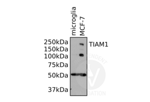 TIAM1 抗体  (AA 1-378)