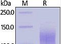 SARS-CoV-2 Spike S1 Protein (His tag) ABIN6952427