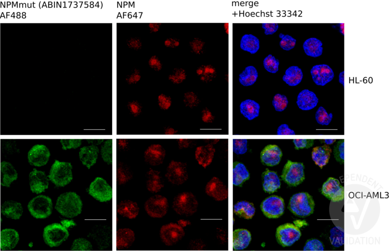 Immunofluorescence validation image for anti-Nucleophosmin Antibody.