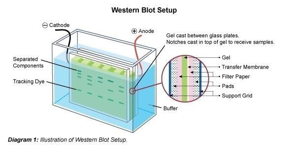 Preparación de Western Blot