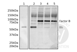 Western blot analysis of purified Bb fragment (1), zymosan activated serum (2), and non-activated sera (3, 4, 5) using ABIN5692886. 