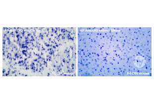 Positive control with Alkaline Phosphatase Anti-Digoxigenin antibody on P5 CD1 mouse brain. Images show reaction with (positive control) and without (TUNEL reaction) DNase treatment. Magnification: 40x.
