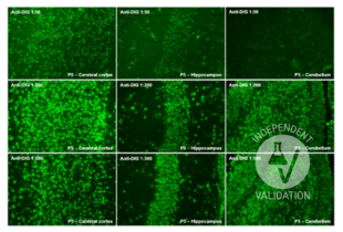 Digoxigenin (DIG) immunoreactive cells in the cerebral cortex, hippocampus and cerebellum of P5 CD1 mice. Sections were treated with DNase and subjected to TUNEL reaction. Magnification: 40x.