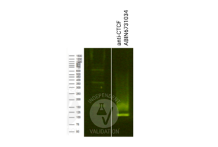 Library profiles comparing fragment size distributions on an E-Gel EX 2% agarose gel (Thermo Fisher). Fragments obtained from CUT&RUN using CTCF ABIN6731034 (right) after library preparation, compared to the E-Gel Sizing DNA Ladder (Thermo Fisher) (left). 