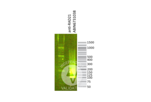 Library profiles comparing fragment size distributions on an E-Gel EX 2% agarose gel (Thermo Fisher). Fragments obtained from CUT&RUN using RAD21 ABIN6731038 (right) after library preparation, compared to the E-Gel Sizing DNA Ladder (Thermo Fisher) (left).