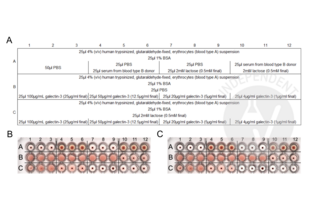 Galectin 3 Protein (LGALS3)