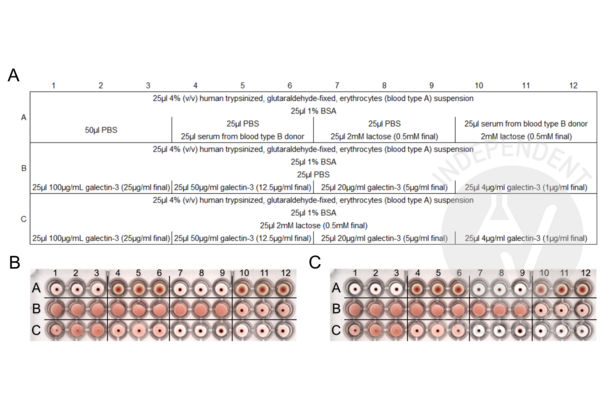 Galectin 3 Protein (LGALS3)