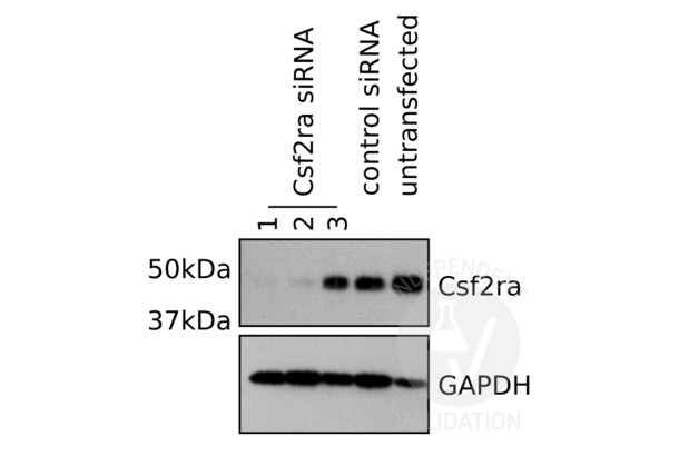 CSF2RA Antikörper  (Center)