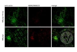 IF staining with ABIN2966633 of kidneys harvested from 14 week old MRL/lpr mice sufficient and deficient in factor H. Cryosections were fixed, stained and images acquired as described in the protocol.