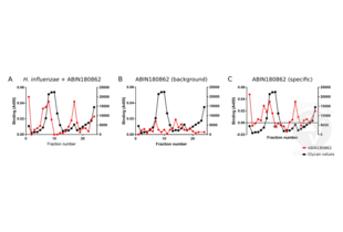 Enzyme Immunoassay validation image for anti-Haemophilus Influenzae antibody (ABIN180862)
