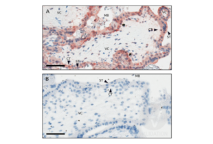 Immunohistochemistry validation image for anti-Keyhole Limpet Hemocyanin (KLH) antibody (ABIN401183) (KLH antibody)