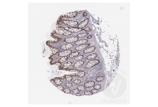 Staining of human rectum section in a tissue microarray with ABIN3044226. See the protocol for detailed information.