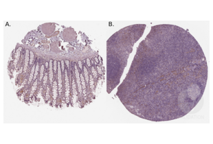 Immunohistochemistry validation image for anti-Insulin Receptor Substrate 1 (IRS1) (AA 106-122), (N-Term) antibody (ABIN3042564) (IRS1 antibody  (N-Term))