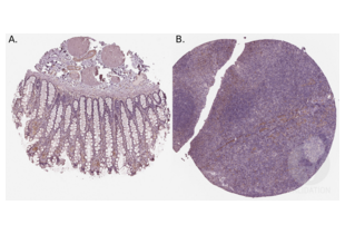 Immunohistochemistry validation image for anti-Insulin Receptor Substrate 1 (IRS1) (AA 106-122), (N-Term) antibody (ABIN3042564)