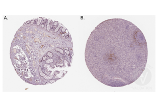 Staining of human colon (A.) and spleen (B.) sections in a tissue microarray with ABIN3044076. See the protocol for detailed information.
