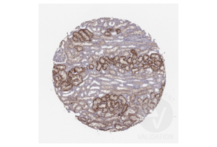 Staining of human kidney section in a tissue microarray with ABIN3044261. See the protocol for detailed information.