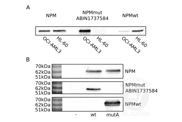 NPM1 抗体  (C-Term)