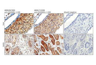 IHC staining of liver and testis tissue with CD200R1 antibody ABIN2847869. For liver, the 400X magnification shows labeling of hepatocyte membranes and no labelling of the wall of the central vein. Also note variation in staining intensity. The photomicrograph of the testis is shown at a lower magnification (200X) in order to show heterogeneity of seminiferous tubule staining intensity.  V, central vein wall; L, liver cells; S, testicular stroma; ST, seminiferous tubule.
