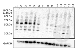Western Blotting validation image for anti-Complement Component C9 (C9) (AA 191-220), (Center) antibody (ABIN657704)