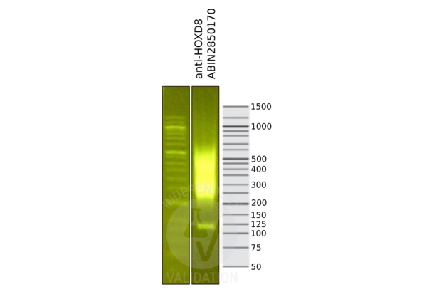 HOXD8 Antikörper  (C-Term)