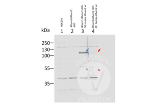 Western Blotting validation image for anti-Rhomboid 5 Homolog 2 (RHBDF2) (AA 80-109), (N-Term) antibody (ABIN2846535) (RHBDF2 antibody  (N-Term))