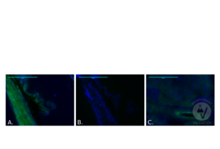 Immunohistochemistry validation image for anti-Carbonic Anhydrase 12 (CA12) (AA 161-318) antibody (ABIN3204699)