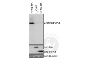 Western blot analysis of lysates from 293T cells ectopically expressing HA-tag labeled human MFN1 (MFN1-HA), luciferase (LUC-HA), and human MFN2 (MFN2-HA). Protein bands were revealed using ABIN5013951, an HA-tag antibody, an MFN2 antibody, and a beta-actin loading control. 