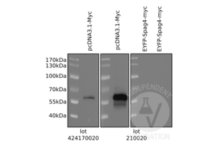 ABIN1532205 lot 424170020 (let panel) and lot 210020 (middle and right panel) detected a protein in the expected molecular mass range exclusively when Myc is expressed (pcDNA3.1-Myc) but did not react with the Myc-tagged SPAG4 (EYFP-Spag4-myc; expected MW approximately 50kDa). 