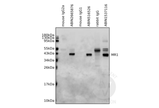 Lysates from human MR1-expressing HEK293 cells were immunoprecipitated by antibodies specific for MR1 (ABIN2665876, ABIN516526, ABIN1537116) or the respective isotype controls (mouse IgG2a, mouse, IgG1, rabbit IgG). Immunoprecipitants were resolved by SDS-PAGE gel followed by Western blotting analysis using MR1 antibody ABIN1537116. 