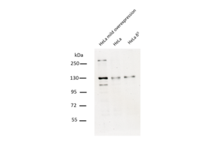75µg total protein of HeLa cells overexpressing PEO1 (lane 1), HeLa cells (lane 2), and rho0 Hela cells (lane 3) were separated on an denaturing 8% polyacrylamid gel. Bands were revealed as described in the protocol sections with ABIN2775251 diluted 1:1000.