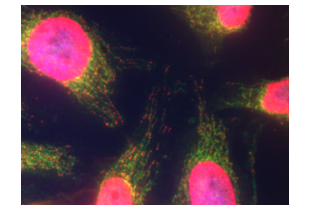 ABIN2775251 was used at a 1:200 dilution to visualize PEO1 (green, secondary antibody AF488 conjugate). A dsDNA antibody (red, secondary antibody AF594 conjugate) and a DAPI counterstain (blue) were used as reference.