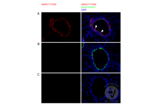 Staining of mouse WT bronchioles with CYP4B1 antibody ABIN2777006 (red), DAPI (blue), and an acetylated alpha-tubulin specific antibody (cilia, green). CYP4B1 is detected in non-ciliated cell in untreated lung tissue (arrowheads) (A). No CYP4B1 staining of naphthalene treated samples (B) and the secondary antibody only negative control (C).