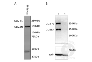 A Detection of endogenously expressed GLI2 with ABIN2777474 in total cell lysates of the human melanoma cell line WM793B. Both the full length protein (GLI2 FL) as well as the ΔN (GLI2ΔN) isoform are detected. B Detection of endogenously expressed GLI2 with ABIN2777474 in human metastatic melanoma tissue (T) compared to human healthy skin tissue that does not express GLI2 (H). Both the full length protein as well as the ΔN isoform are only detected in metastatic melanoma. 