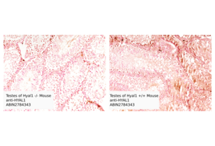 Immunohistochemistry validation image for anti-Hyaluronidase-1 (HYAL1) (N-Term) antibody (ABIN2784343)