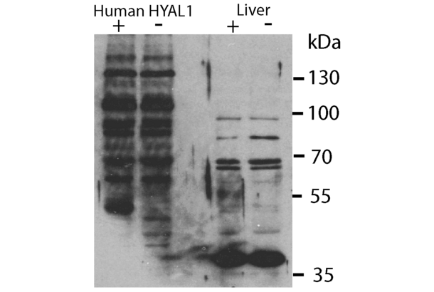 HYAL1 anticorps  (N-Term)