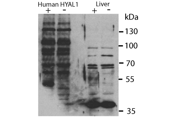 HYAL1 Antikörper  (N-Term)