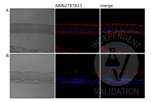 IHC staining of NRD1 using ABIN2787813 (red, middle) on retina from horses suffering from equine recurrent uveitis (A) and non-ERU infected horses (B). Counterstain with DAPI (blue) and an anti-Vimentin antibody (green). 