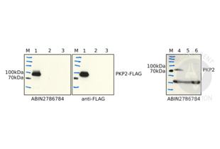 Western blot of lysates from HEK293 cells transfected with FLAG-tagged PKP2 (1), non-transfected HEK293 cells (2), non-transfected HL1 cells (3) HEK293 cells transfected with ABIN2786784 or an anti-FLAG tag antibody. In addition, lysates from human (4) and mouse heart tissue (5, 6) were incubated with ABIN2786784. 