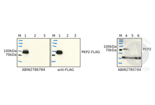 Plakophilin 2 antibody  (N-Term)