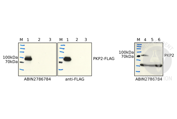 Plakophilin 2 antibody  (N-Term)