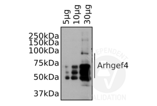 Indicated amounts of total protein from primary mouse microglia cell lysate were separated on a denaturing SDS-PAGE gel and incubated with ABIN2787993 as described in the protocol.